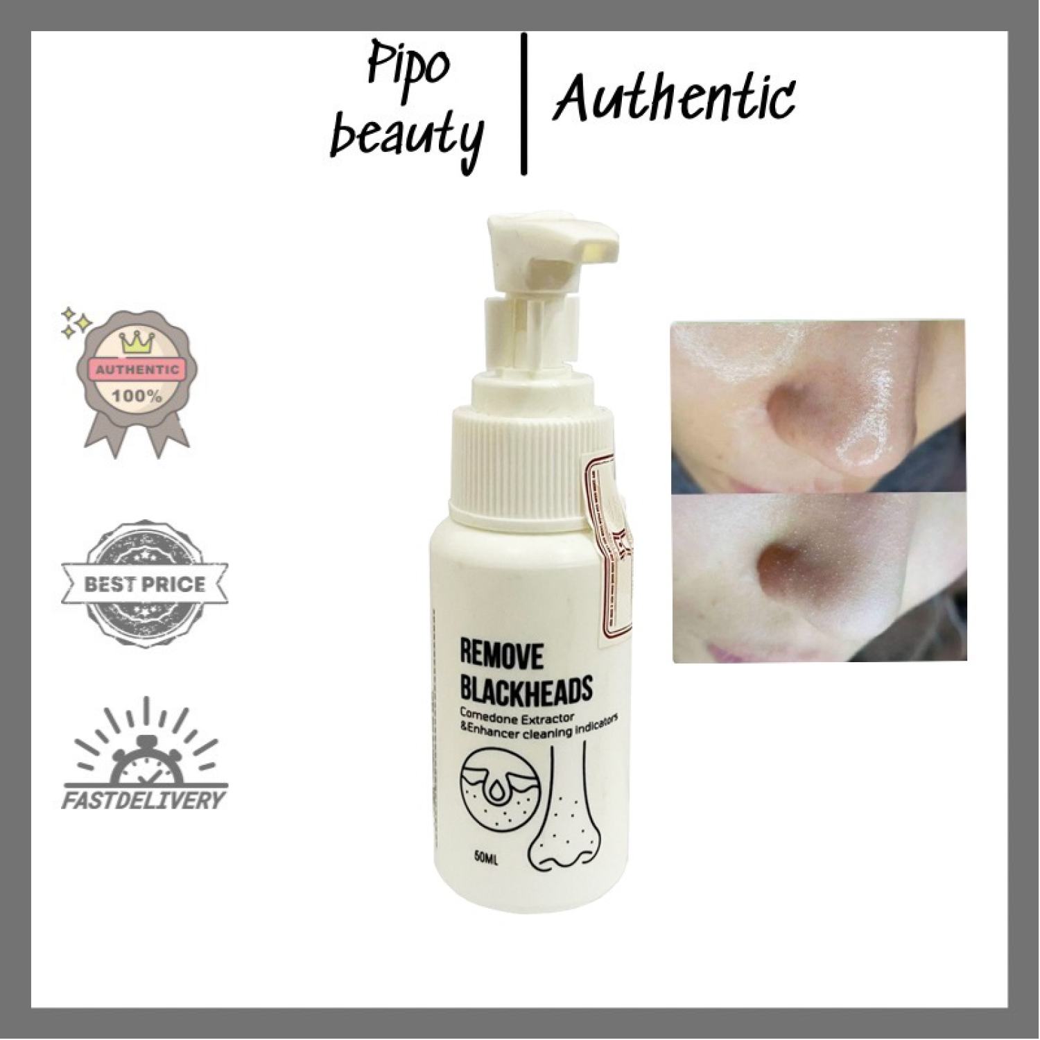 Ủ mụn đầu đen Removes BlackHeads 50ml