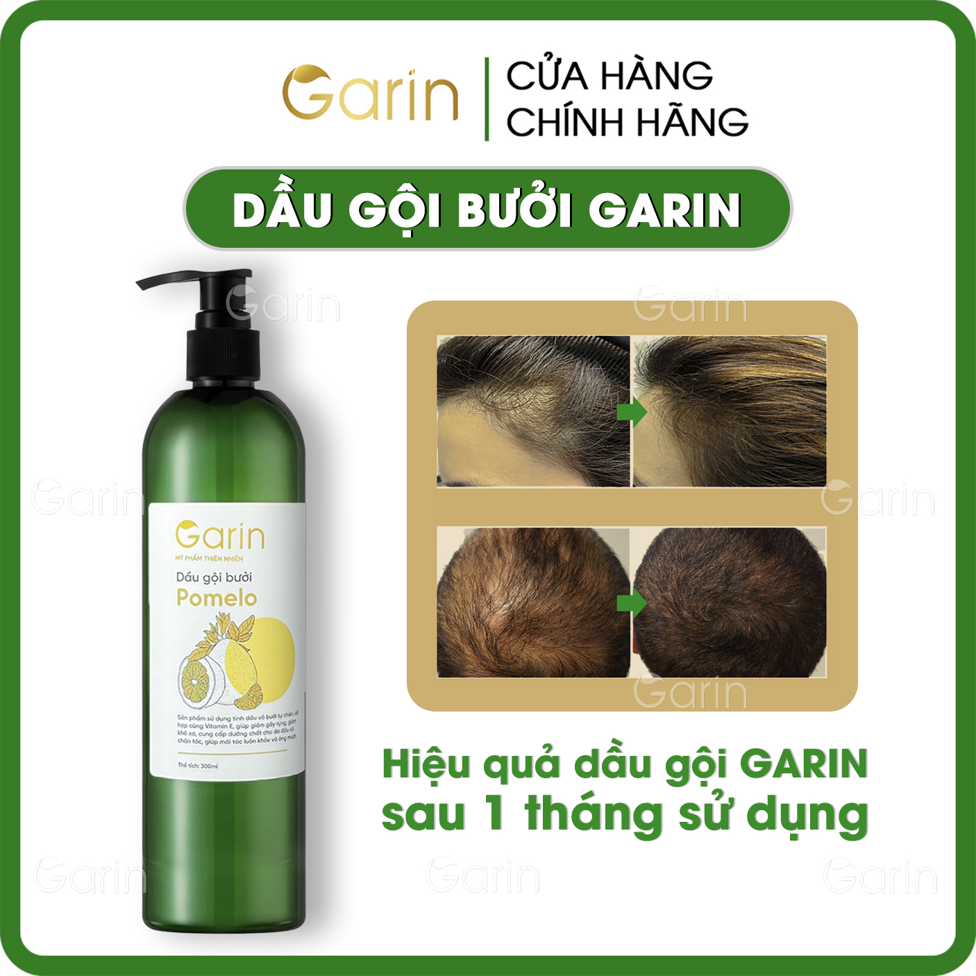 Dầu gội bưởi kích mọc tóc tinh dầu bưởi pomelo Garin 300ml dưỡng tóc kích mọc tóc nhanh gấp 2 đến 3 lần, làm sạch tóc và da đầu, giảm rụng tóc rõ rệt