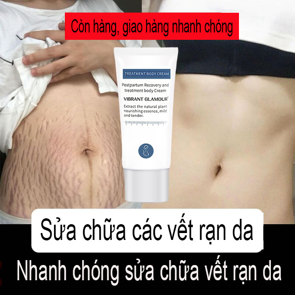 [HCM]Kem Xoá Sẹo, Làm Mờ Rạn Da, Kem Mờ Sẹo, Kem Phục Hồi Làm Mờ Vết Rạn Da Trước Và Sau Sinh.