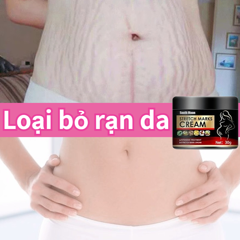 Nhanh chóng xóa rạn da，kem loại bỏ vết rạn da, Kem loại bỏ sẹo 30g,kem làm mờ vết rạn，làm mờ vết rạn sau sinh, làm săn chắc da cho bà bầu,Kem ngăn ngừa và làm giảm rạn da khi mang thai, giảm nếp nhăn do tăng cân hoặc mang thai