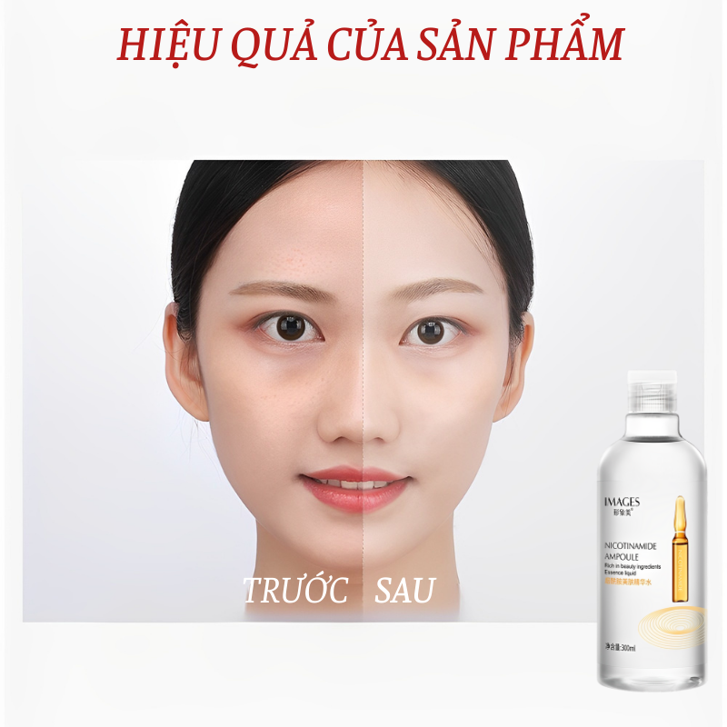 Toner sáng da cấp nước cân bằng da IMAGES với tinh chất Nacinamide Nước Hoa Hồng Tinh Chất Cấp Nước Dưỡng Ẩm Cho Da, Nước cân bằng da , cân bằng độ PH 300ML