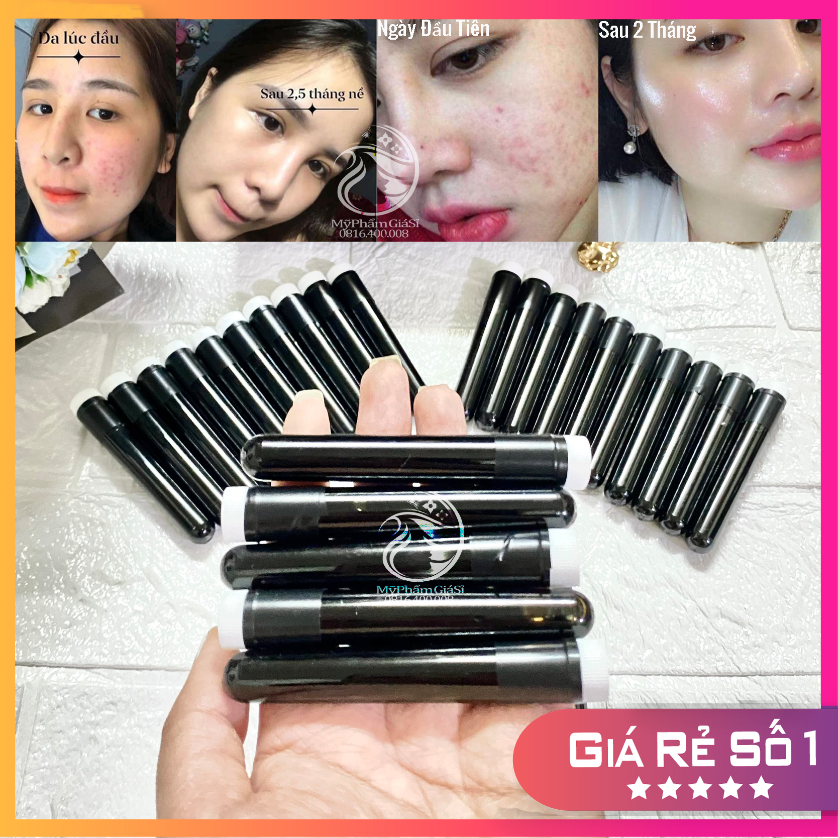 5 Ống Cao Lá Nam Loại Bỏ Các Loại Mụn Tận Gốc Hàng Chuẩn Không Pha Tạp Chất Ống 5ml Handmade Chuyên Sỉ Spa