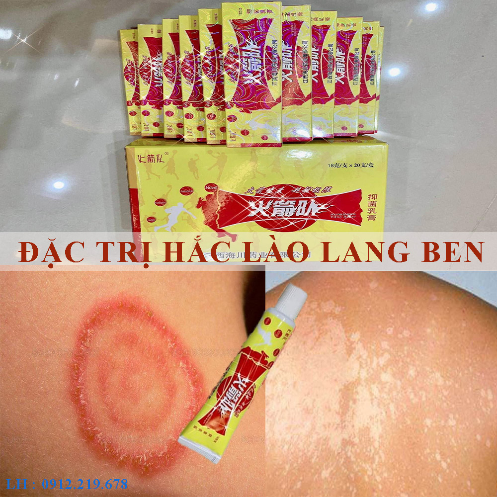 Ghẻ nước hắc lào lang ben nấm da kem bôi nội địa TQ