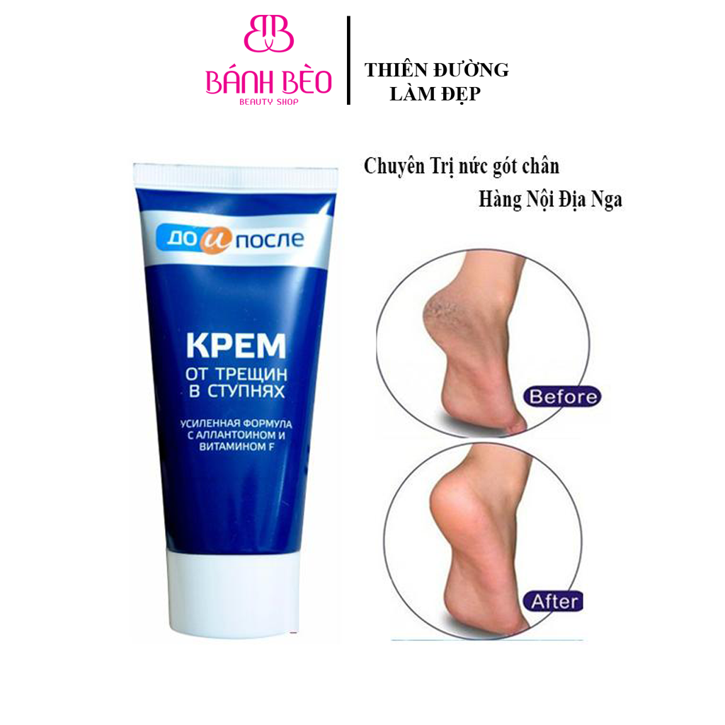 Kem dưỡng gót chân kpem apteka của nga 50ml