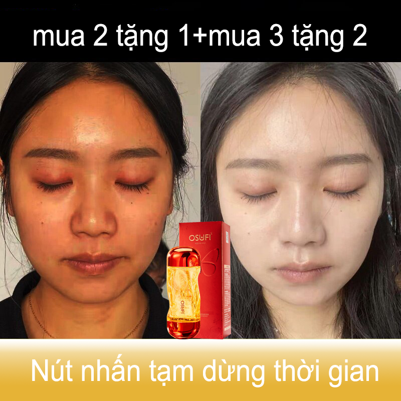 Tinh chất serum phục hồi, tinh chất serum làm trắng, tinh chất serum bảo dưỡng 200ml dưỡng trắng làm sáng, sửa chữa da, giảm bụi bẩn, nâng cơ săn chắc, làm đẹp, cải thiện da vàng sạm