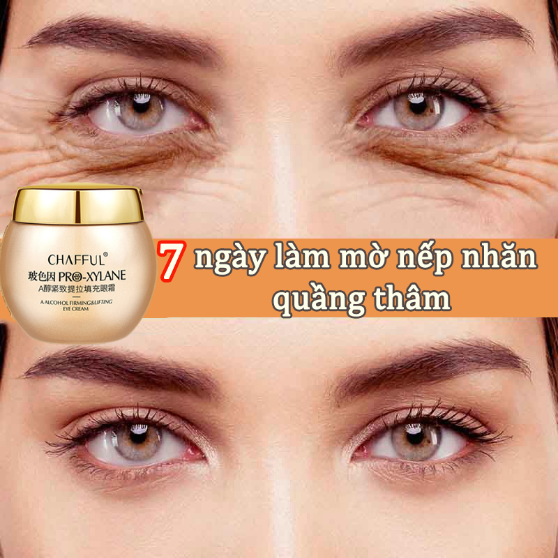 👍🏻Chính Hãng👍🏻 kem dưỡng mắt kem chống lão hoá kem mắt 60g loại bỏ quầng thâm làm mịn nếp nhăn loại bỏ túi mắt