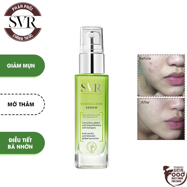 Tinh chất làm giảm mụn, mờ thâm sáng da, làm mềm mịn da svr sebiaclear serum 30ml
