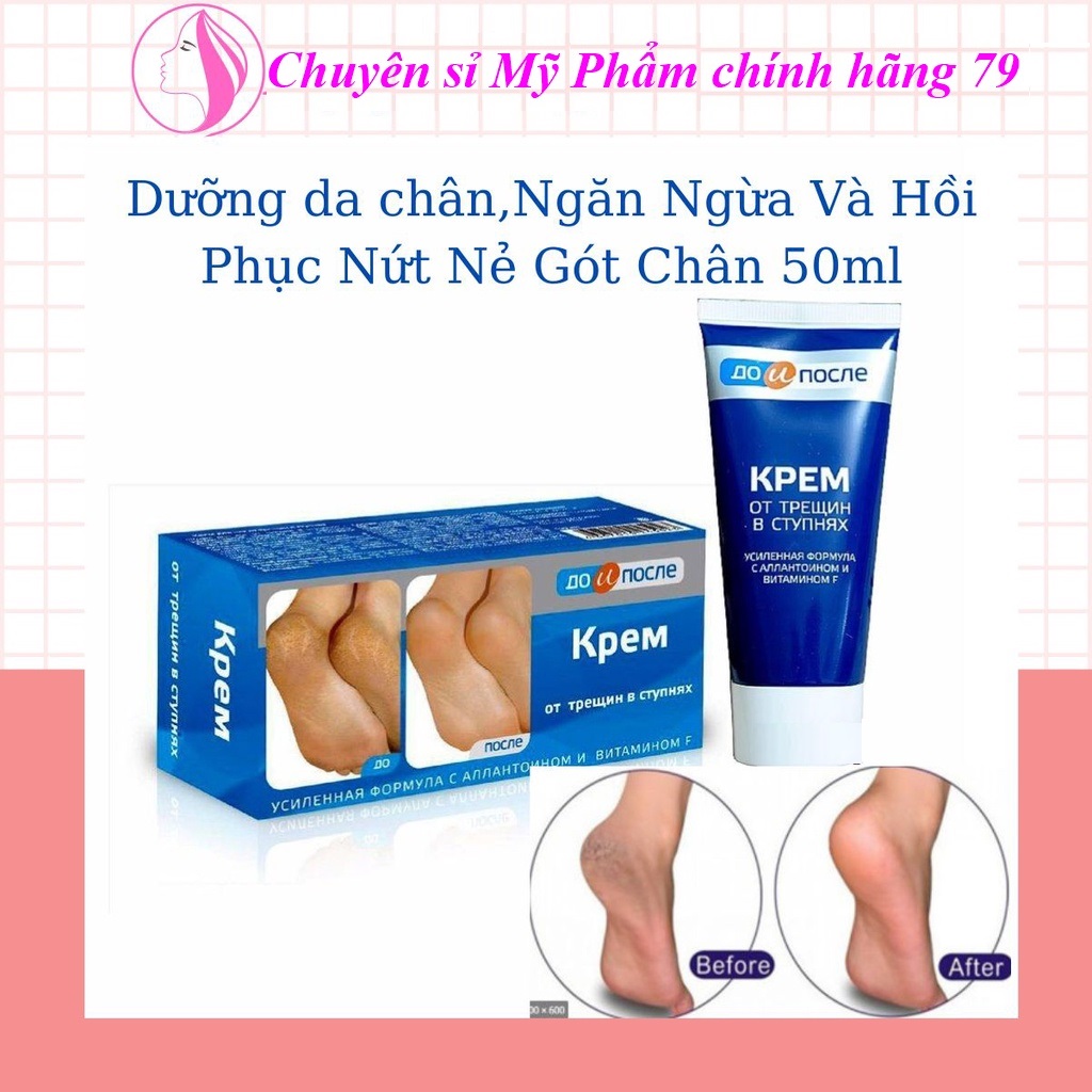 [Freeshipmax] Kem gót chân Kpem Nga 50ml, kem mờ nứt gót chân, Dưỡng da chân tay, hết chai sạn, nứt nẻ gót chân, Hiệu Quả nhanh chóng