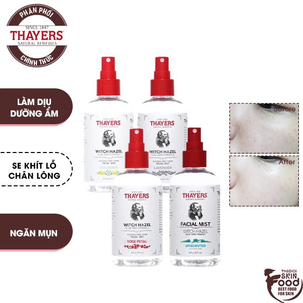 Nước Hoa Hồng Dạng Xịt Không Cồn Giúp Làm Sạch, Dịu Da Thayers Witch Hazel Aloe Vera Formula Facial Mist