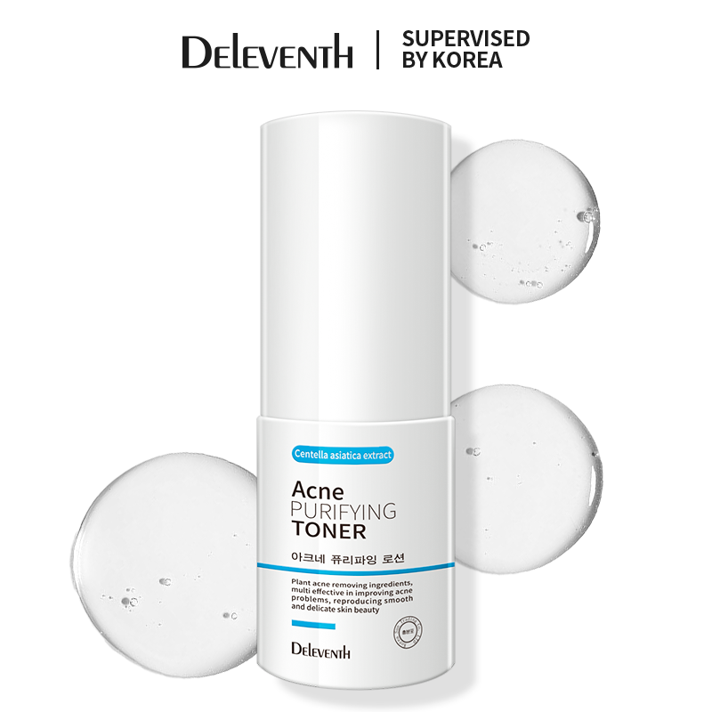 Serum giảm mụn, thích hợp cho da dầu. Toner Tẩy Tế Bào Chết Cho Da Nhạy Cảm Acne Solution Toner 30ml