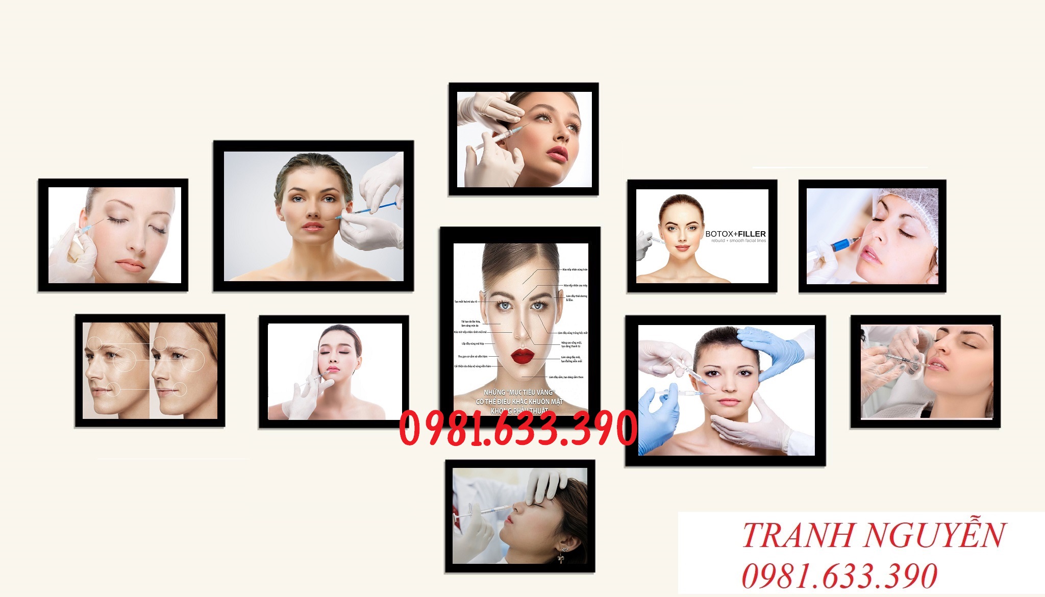 BỘ 11 TRANH FOMEX: TRANH SPA, TIÊM FILER
