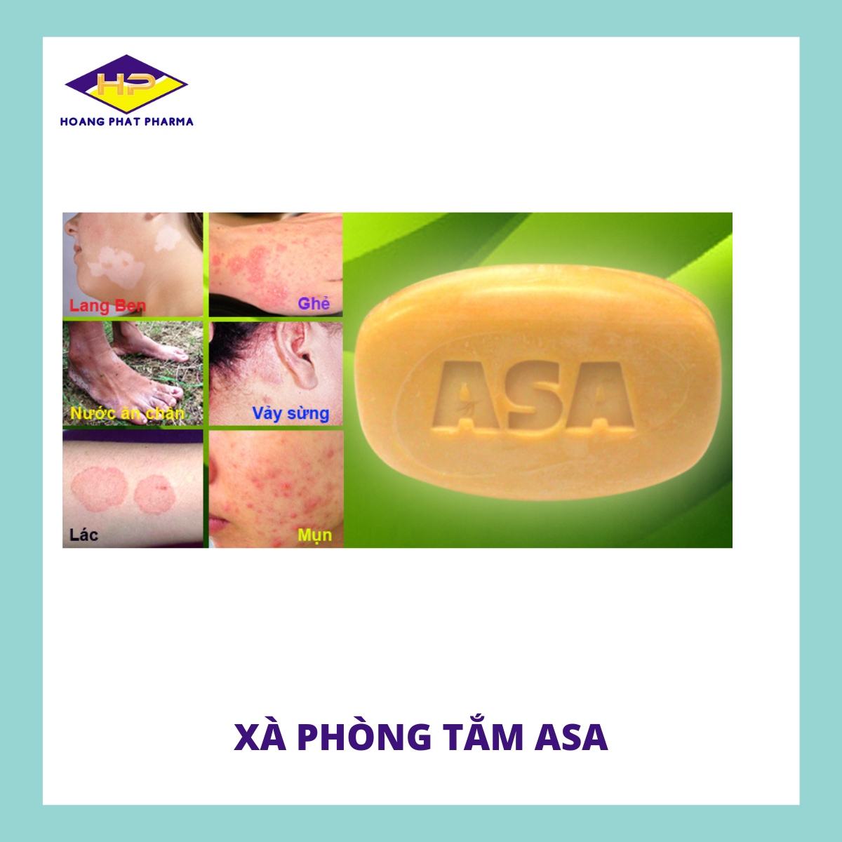 Xà phòng tắm folia asa - hỗ trợ trị mụn da lác lang ben ghẻ nước ăn chân vảy sừng - hoàng phát - asaxaphong