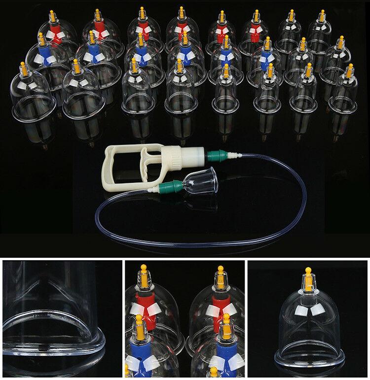 Giác hơi không dùng lửa ,Giác hơi hút máu độc, giác hơi ở đâu, giác hơi cạo gió, bộ giác hơi bộ giác hơi 24 ống chân không cao cấp.