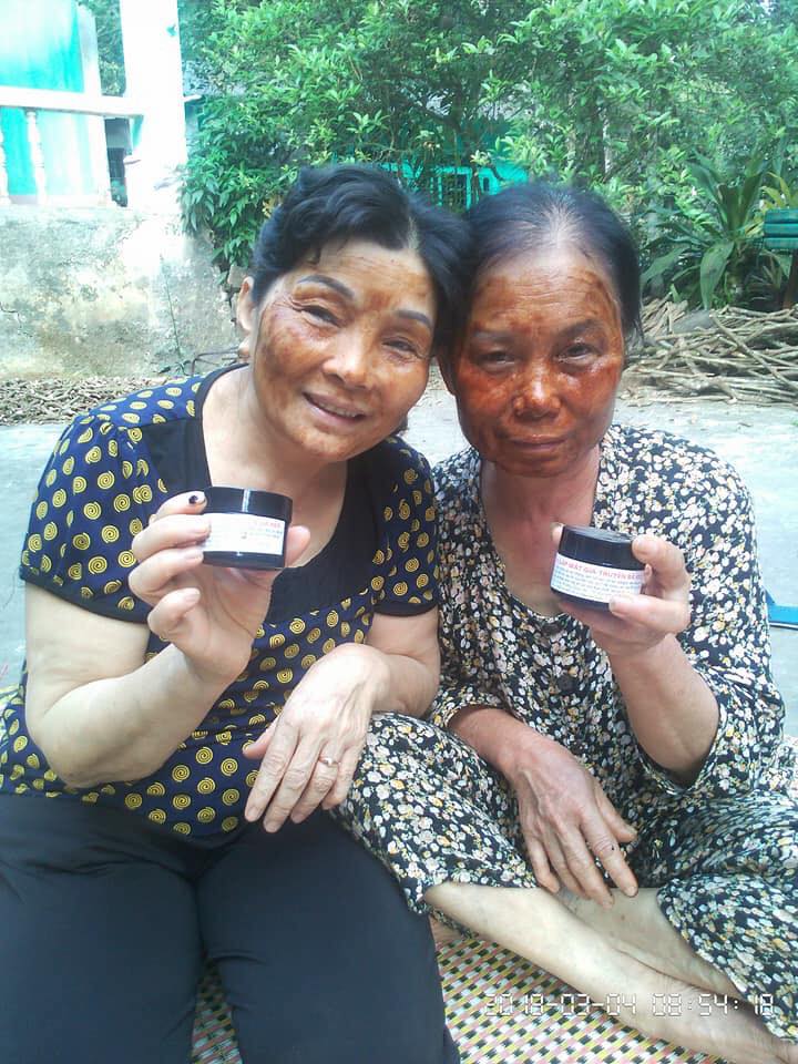 Cao Đắp Mặt Gia Truyền Bà Reo Hỗ Trợ Trị Mụn Trứng Cá, Tàn Nhang Làm Mờ Sẹo Tái Tạo Collagen Làm Trắng Da Đẹp Da Nine's Beauty Thành phần Hoa hồng , Xả mật ong và các thảo dược quý khác.