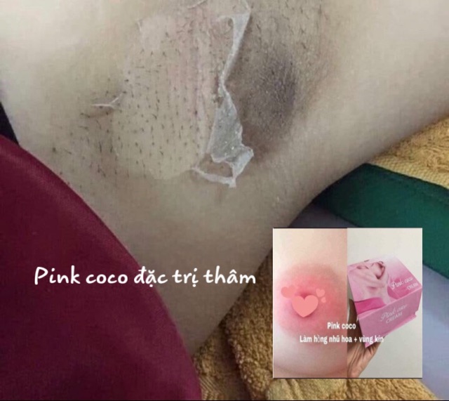 Kem làm hồng nhũ hoa - vùng kín pink coco