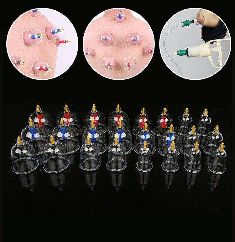 Giác hơi không dùng lửa ,Giác hơi hút máu độc, giác hơi ở đâu, giác hơi cạo gió, bộ giác hơi bộ giác hơi 24 ống chân không cao cấp.