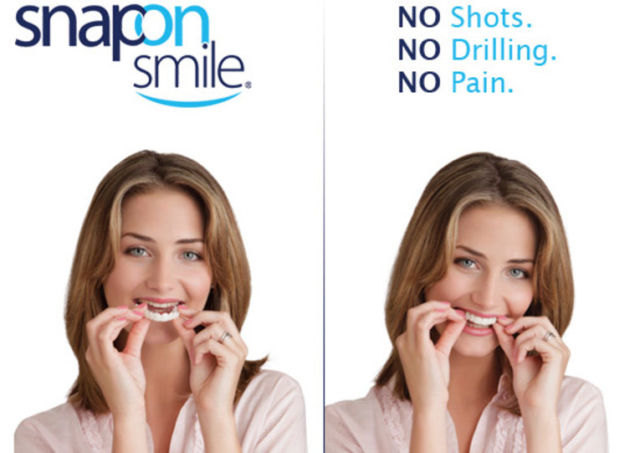 Răng giả Snap on smile