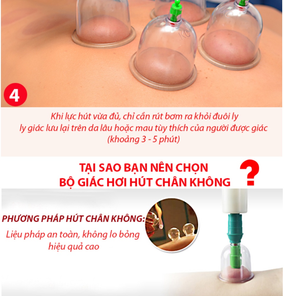 [ XẢ HÀNG ] Dụng cụ giác hơi  Cửa Hàng Bán Thiết Bị Y Tế Bộ Giác Hơi chân không - Bộ Dụng Cụ Giác Hơi 12 Ly Không Dùng Lửa Duy Thành Giác Hơi Ngay Tại Nhà Tiện Lợi