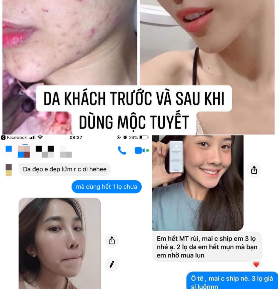 Chính Hãng Huyết thanh Mộc Tuyết,xoá mụn,thâm,trắng da tái tạo làn da 6