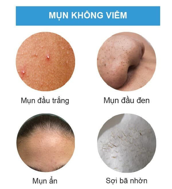 Kem Mụn Dr SKIN ACNE