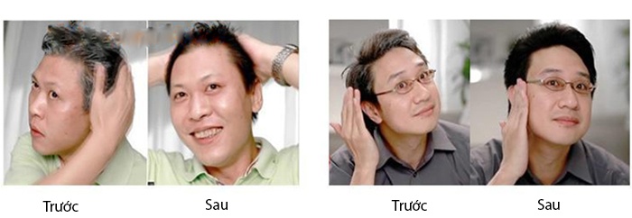 Bộ lược nhuộm tóc thông minh MY Tejing ALIANG và lõi thay thế thuốc nhuộm (Đen)