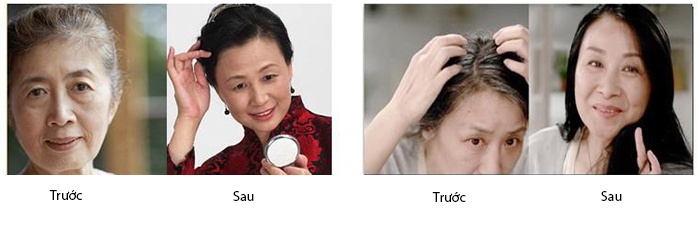 Bộ lược nhuộm tóc thông minh MY Tejing ALIANG và lõi thay thế thuốc nhuộm (Đen)