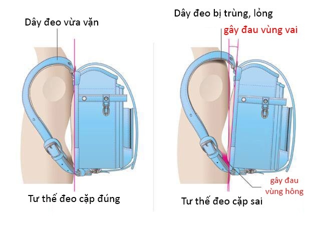 Cặp chống gù Nhật Bản Randoseru khóa tự động màu Hồng Nhạt 3